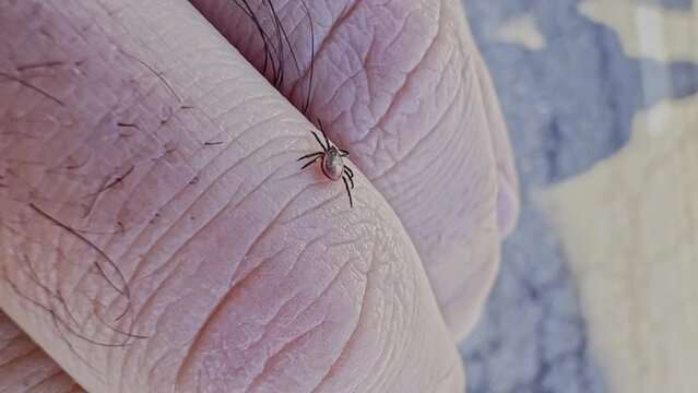 Macro shot of a tick walking on the skin of the hand, ready to bite and transmit diseases. A forest tick crawls on a man's arm. Macro. Blood-sucking insect on the human body close-up. Tick on the Skin