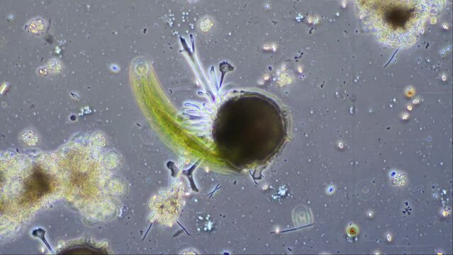 A testate amoeba, Diffulgia coronata, under the microscope at 200x magnification in phase contrast. This time lapse highlights its extending pseudopods, used to move, probe the environment and feed.