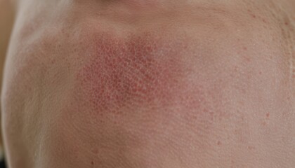 Fototapeta premium A close up of a man's face with a red spot on his neck