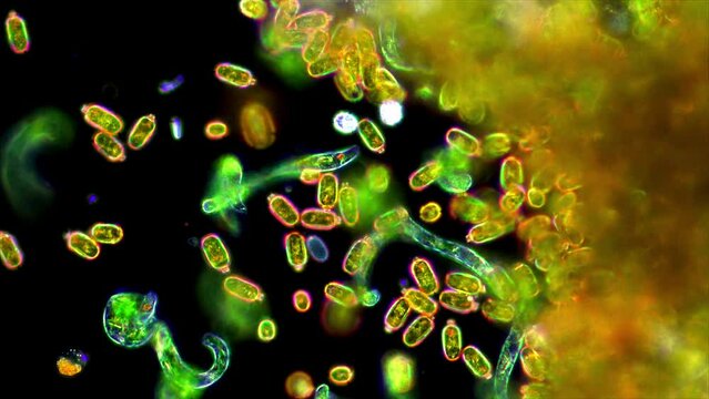 Vibrant, neon-color microbes: Lepocinclis and Trachelomonas, two types of Euglenoid microorganisms, seen under the microscope in polarized light at 400x magnification.