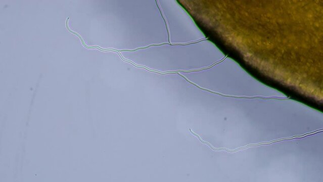 rare footage of sea anemone shooting urticating nematocysts and releasing toxing under the microscope. 200x magnification