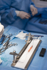 Arthroscopic anterior cruciate ligament reconstruction
