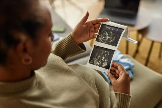 Top down view of baby sonogram pictures in hands of unrecognizable anticipating pregnant woman