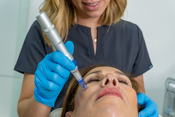 close-up young female esthetician with microneedling pen on old woman