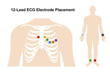 Electrocardiogram. Chest (Precordial) Electrodes and Placement. Heart cardiogram. Vector illustration in flat style isolated on white background