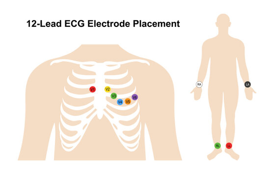 Electrocardiogram. Chest (Precordial) Electrodes and Placement. Heart cardiogram. Vector illustration in flat style isolated on white background