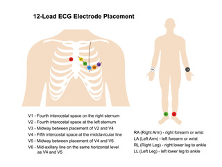 Electrocardiogram. Placement of 12-lead ECG electrodes on the human chest and body with main parts labeled. Heart cardiogram. Vector illustration in flat style isolated on white background