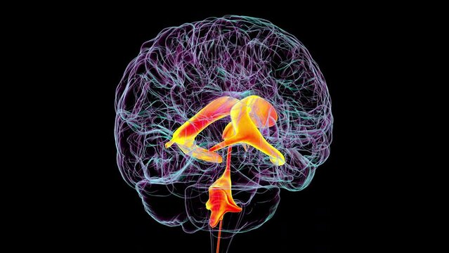 Ventricular system of the brain, 3D animation. The ventricles are cavities in the brain that are filled with cerebrospinal fluid (CSF).