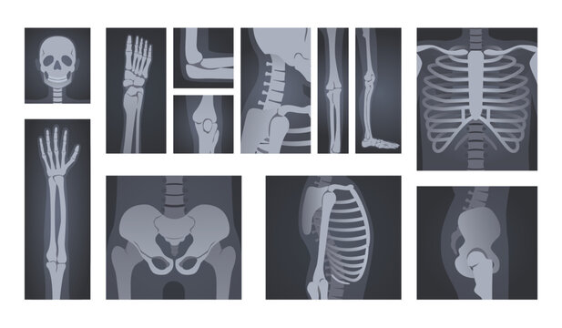X-ray shots. Human body radiology of head skull, hand bones, spine and rib cage vector illustration set