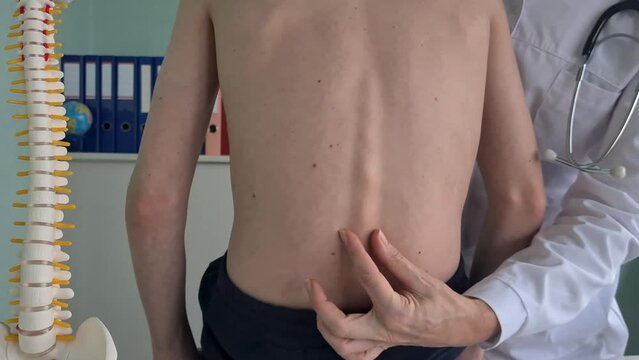 Man at a doctor appointment with back pain. Treatment of spinal deformity and stoop in adolescents