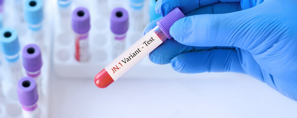 Doctor holding a test blood sample tube with SARS-CoV-2 Variant JN.1 virus test on the background...
