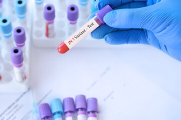 Doctor holding a test blood sample tube with positive SARS-CoV-2 Variant JN.1 virus test on the...