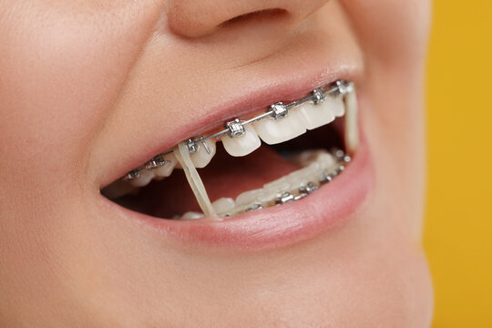 Elastics Images