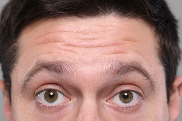 Closeup view of man with wrinkles on his forehead - obrazy, fototapety, plakaty