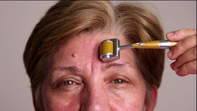 portrait head shoot of beautiful elder woman using derma roller with needles for facial rejuvenation, face anti aging wrinkle procedures at home. smiling female granny
