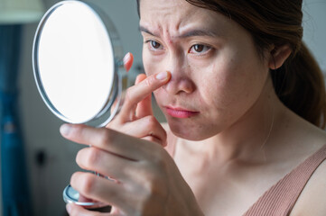 Asian woman worried about her face when she saw acne and wrinkled occur on her face by mini mirror.