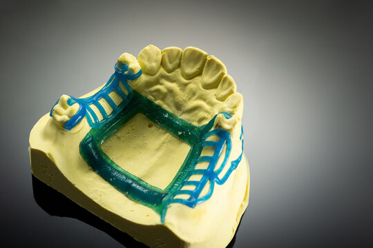 The image of a denture	