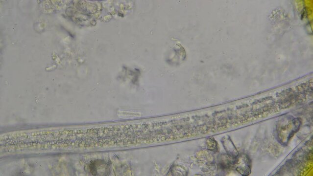 Roundworms nematodes, Steinernema, under the microscope at 600 times magnification with view on the digestive tract