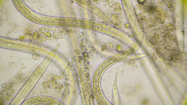 Beautiful shot of strong moving roundworms, nematodes, under microscope at 400 times magnification