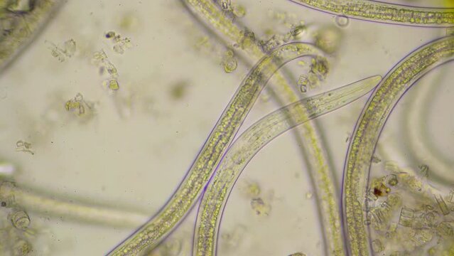 Strong moving roundworms, nematodes, under microscope at 400 times magnification