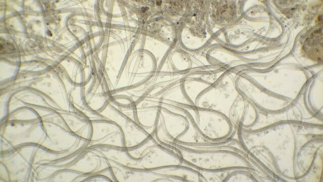 A microscopic view of roundworms nematodes, Steinernema, at 100 times magnification