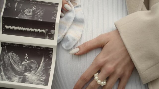 A close-up view of a woman's hands holding baby socks and ultrasound photos, symbolizing the expectancy of a new life, ideal for stock footage themes on pregnancy and family joy.