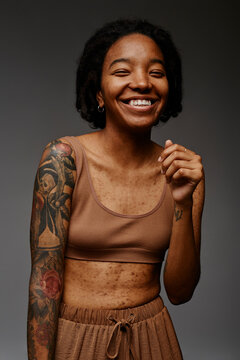 Young woman with acne scars laughing against gray background