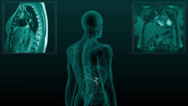 Magnetic resonance tomography  scan of the human digestive system. Anatomically accurate 3d render animation of the Pancreas