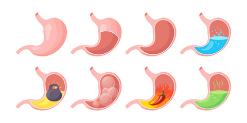 Healthy and unhealthy, empty and full human stomach, icons set. Nutrition, stomach pain, heartburn, heaviness, bloating. Anatomy of the digestive system. vector © Tatiana