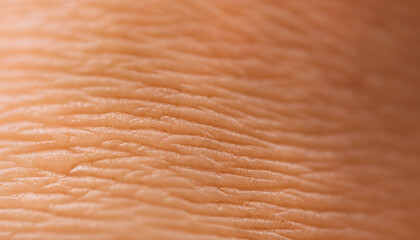 dry and dehydrated human skin texture background; close up; high quality photo