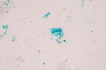 Backgrounds of Bacteria and Mold under the microscope in Lab.