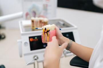 Closeup hands of unrecognizable female dentist holding teeth model and learning about healthy teeth and maintaining oral hygiene in dentistry clinic to patient. Healthcare, dental health concept.