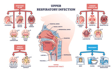Upper respiratory infection with symptoms and types outline diagram, transparent background. Labeled educational health condition scheme with coughing, sore throat and nasal problems illustration. - obrazy, fototapety, plakaty