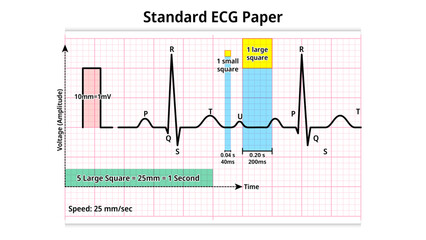 Standard ECG Paper - grid of squares that moves at a speed of 25 mm/s and a voltage of 10 mm/mV - Electrocardiogram Medical Vector Illustration