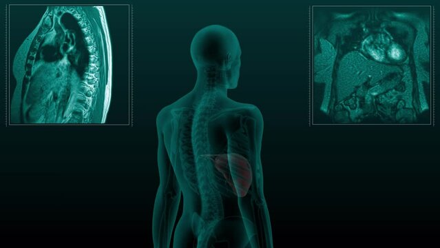 Magnetic resonance tomography  scan of the human digestive system. Anatomically accurate 3d render animation of the liver,