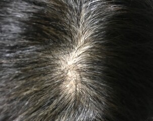 thinning hair and grey hairs in the middle of the woman's head in close-up shot