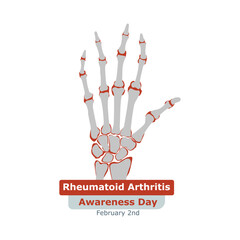 Rheumatoid Arthritis Awareness Day. Rheumatoid arthritis symptom on human joints and bones. Vector, illustration.