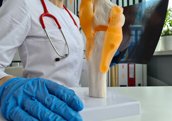 Doctor in blue gloves holding a knee bone model and an X-ray of the knee joint