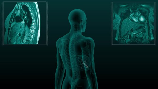 Magnetic resonance tomography  scan of the human digestive system. Anatomically accurate 3d render animation of the gallbladder