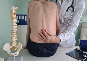 Orthopedist examines spine and posture and spinal deformities of teenage patient