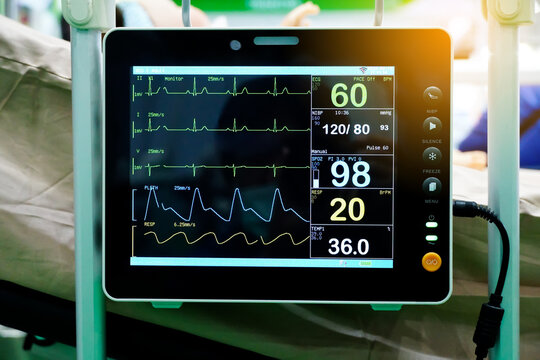 Modern vital sign monitor screen show patient data such as The waves of blood pressure, blood oxygen saturation, ECG, heart rate, close up.