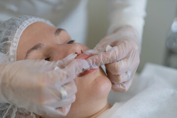 Medical expert assesses enhanced lips, ensuring perfect results. Highlights the personal investment...