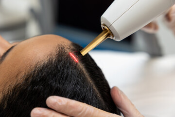 Patient in a beauty clinic having laser procedures for hair