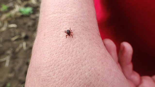 Tick on the Skin Close Up. Ticks Carry Disease. Small Insect Parasite Mite Crawls On a Man's Palm Hand. Tick on the Skin Close Up. Ticks Carry Encephalitis Disease. Blood-sucking Mite 