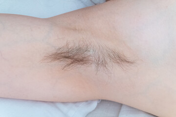 Fototapeta premium Closeup of long dark hair growing under arm of young female. Concept of hygiene, natural beauty, feminity and body hair growth