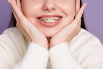 portrait of a girl with braces close-up, woman is happy with braces