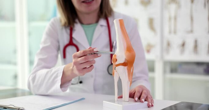 Orthopedic doctor shows anatomical model of knee and tendon closeup. Surgical examination of trauma and arthritis of bones