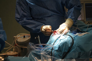 Doctors are surgery to patient at operating room. Real time surgery