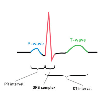 Ventricular repolarization, T wave. The QT interval of ECG. The cardiac cycle. ECG of a heart in normal sinus rhythm. Resources for teachers and students.