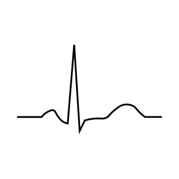 Ventricular repolarization, T wave. The QT interval of ECG. The cardiac cycle. ECG of a heart in normal sinus rhythm. Resources for teachers and students.